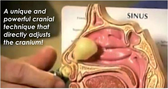 balloon cranial facial release procedure